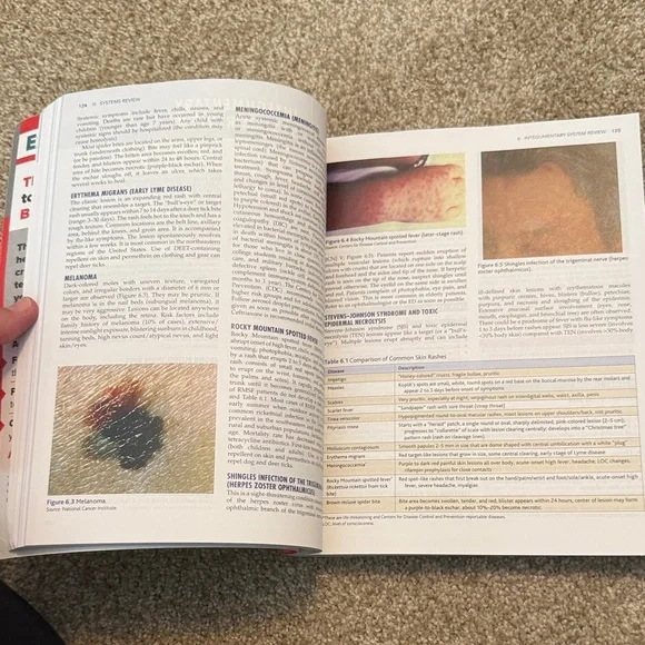 Leik FNP intensive review - Picture 7 of 8